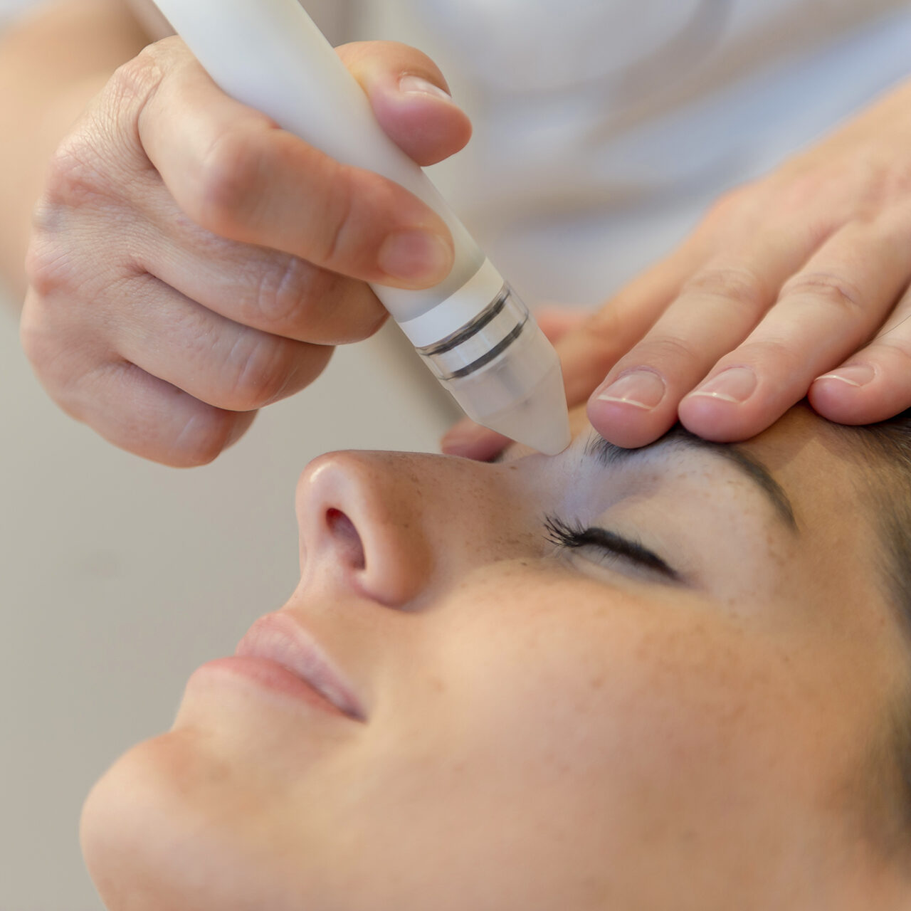A close-up of a persons face receiving a skincare treatment with a handheld device near the eye, while a hand gently holds the forehead.